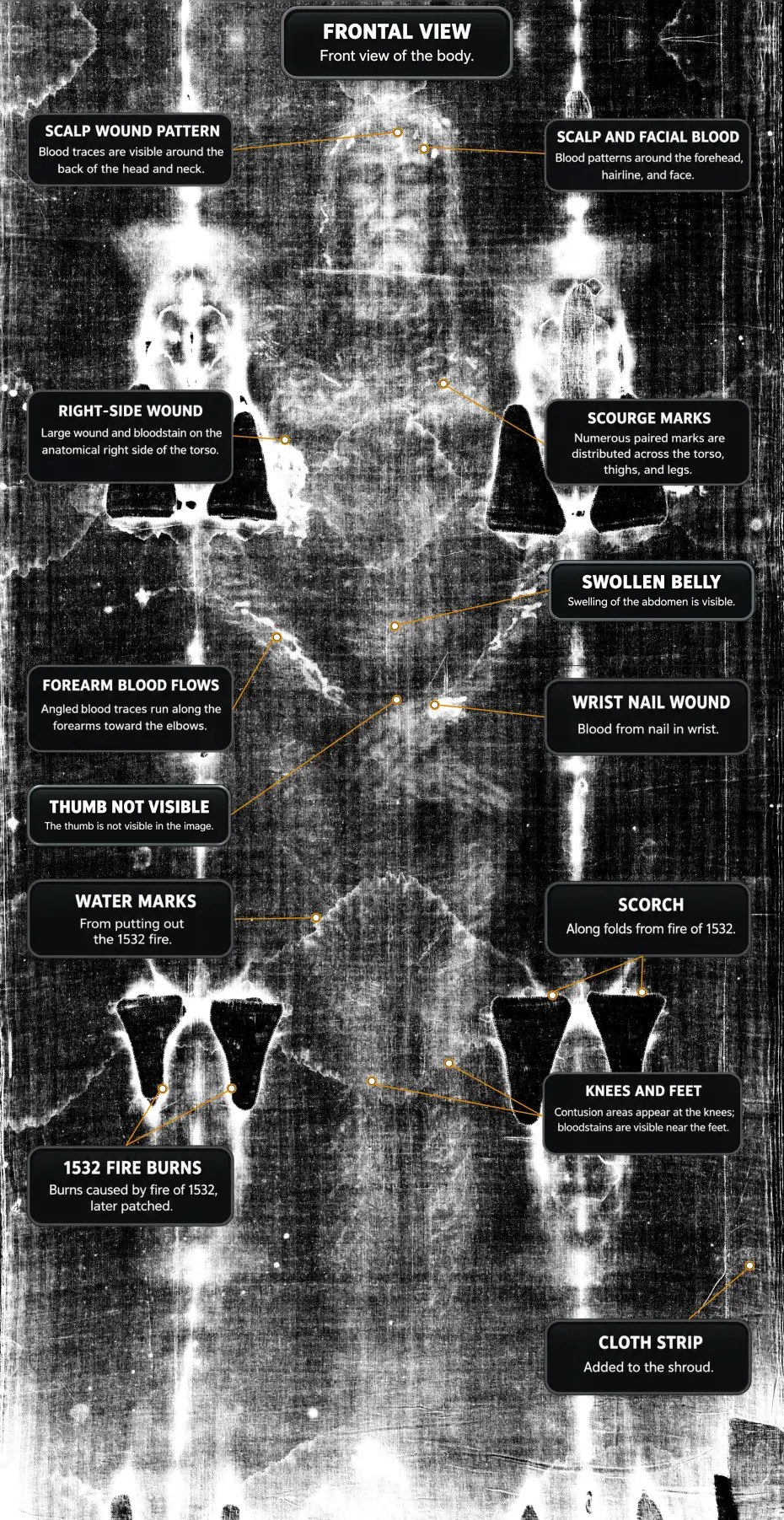 Full frontal image of the Shroud figure, showing the body and the marks of the chest, the side and the legs.