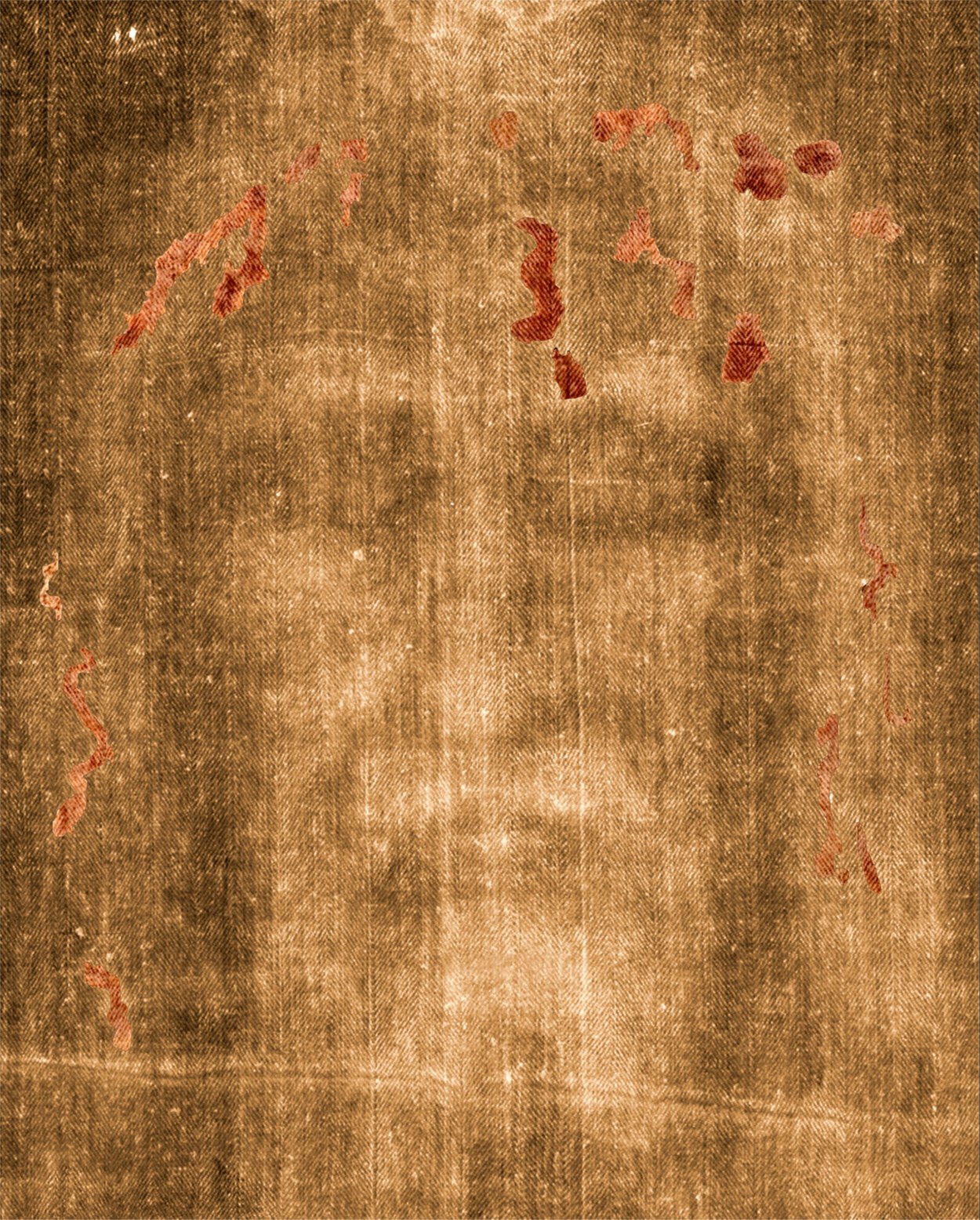 Close view of the forehead on the Shroud with the wound marks highlighted for analysis.